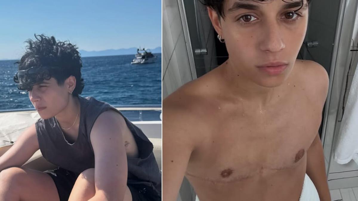 Senza Cri ha rimosso il seno: "Dopo l'operazione, ho visto le cicatrici e ho avuto un attimo di smarrimento, ma questo s